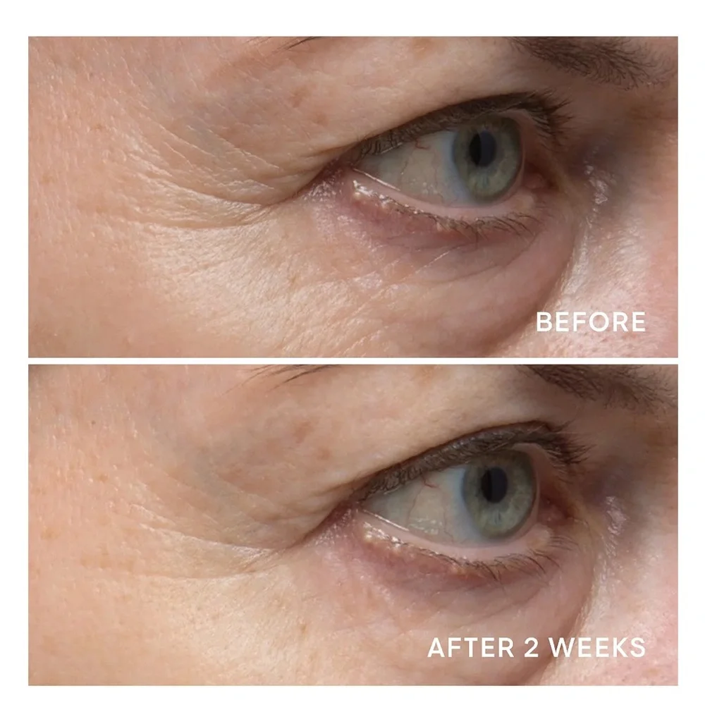 ELEMIS pro collagen